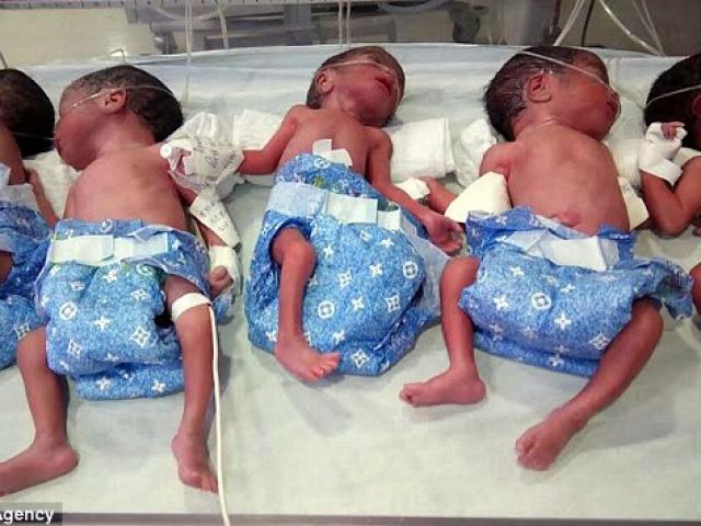 Thế giới - Ca sinh 5 tự nhiên gây kinh ngạc ở Ấn Độ