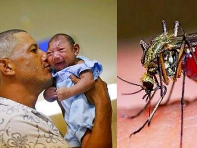Thêm bằng chứng virus Zika liên quan bất thường não thai nhi