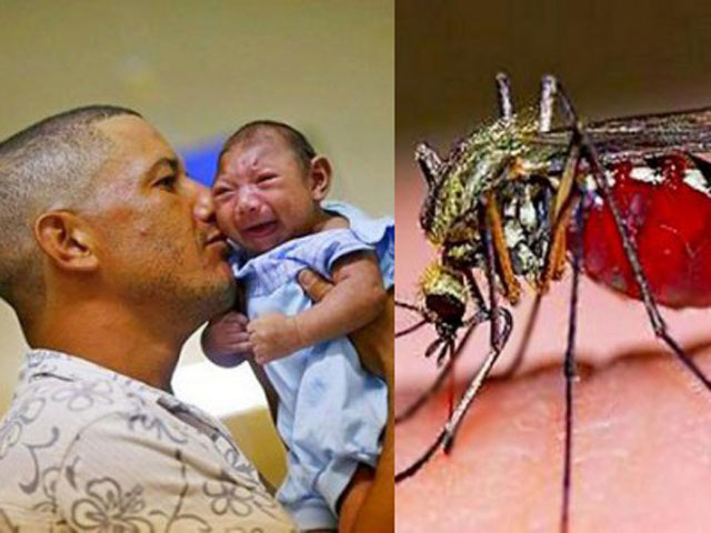 Phụ nữ mang thai nhiễm virus Zika nguy hiểm như thế nào?