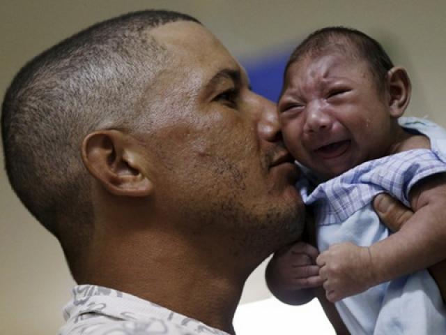 Virus gây teo não Zika đã tấn công 1/3 thế giới