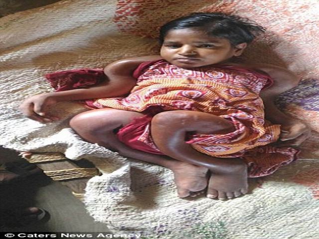 Phi thường - kỳ quặc - Cô gái 25 tuổi bị teo nhỏ cơ thể như bé sơ sinh