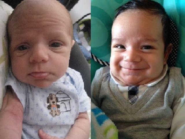 Thế giới - 15 em bé có khuôn mặt “già” như người lớn