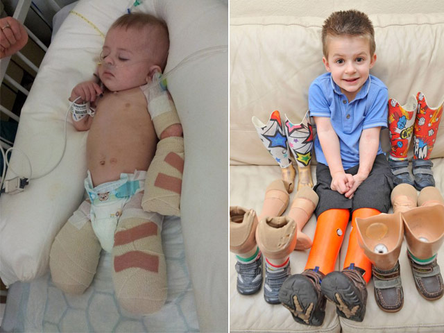 Bạn trẻ - Cuộc sống - Khâm phục nghị lực cậu bé mắc bệnh viêm màng não