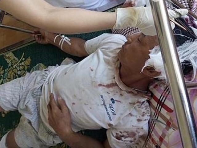 Pháp luật - Con dâu thuê côn đồ “dằn mặt” nhà chồng lĩnh án