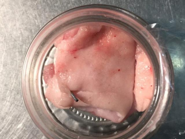 Tin tức trong ngày - Hoảng hồn phát hiện kim tiêm trong thịt heo