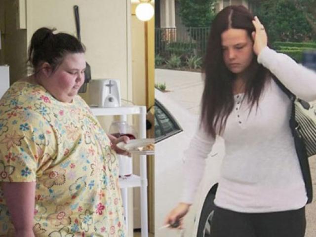 Bạn trẻ - Cuộc sống - Cuộc sống khó tin của cô gái nặng 312 kg cắt bỏ mỡ thừa