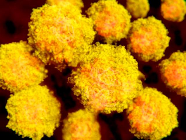 Sức khỏe đời sống - Virus Zika gây đại dịch có nguồn gốc từ châu Á?