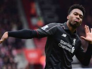 Bóng đá - Tin HOT trưa 20/4: Sturridge được ví như &quot;trái cam&quot;