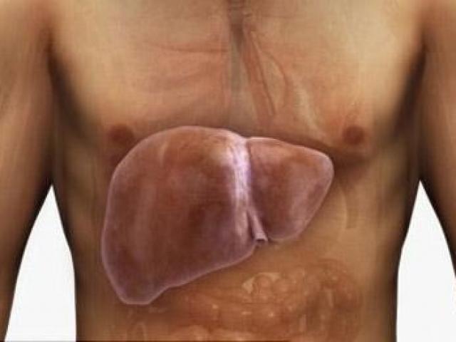 Sức khỏe đời sống - Gần 15 triệu người Việt mang virus gây ung thư cực nguy hiểm