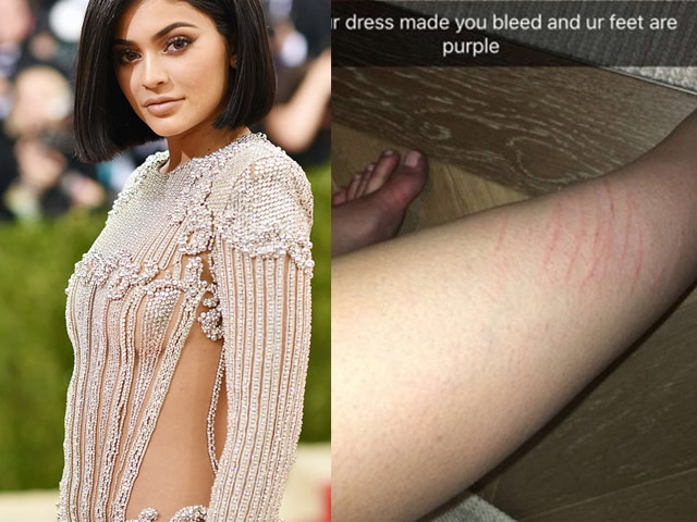 Xu hướng thời trang - “Hot girl Hollywood” gặp nạn vì váy xuyên thấu