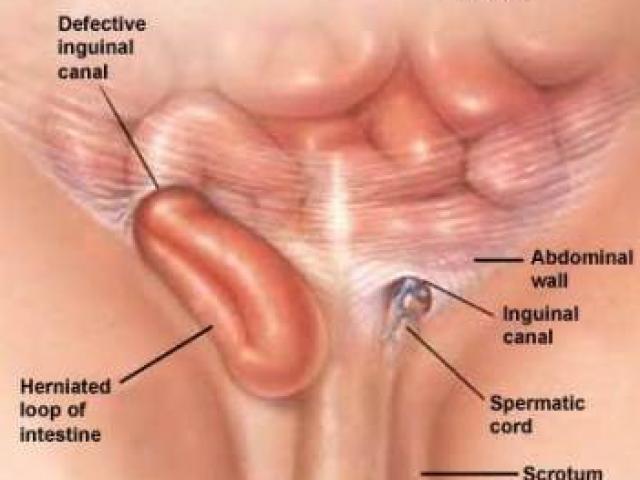 Sức khỏe đời sống - Bố mẹ hoảng hốt khi thấy vùng kín của con phì đại, thâm đen