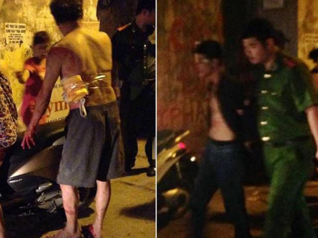 Pháp luật - Con rể gây sự, cầm dao đâm bố vợ nhập viện