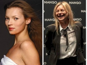 Thời trang - Kate Moss và hành trình tự hủy hoại nhan sắc