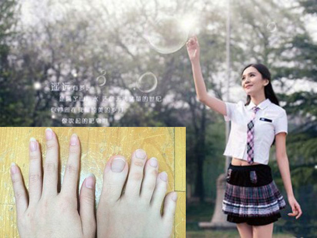 Bạn trẻ - Cuộc sống - Nữ sinh nổi tiếng vì "ngón chân dài như ngón tay"