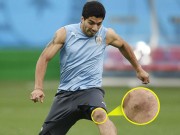 Bóng đá - Tin HOT tối 5/6: Suarez lỡ trận ra quân của Uruguay