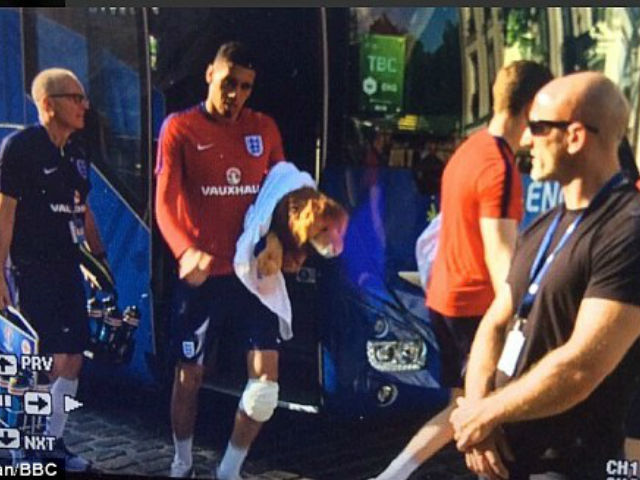 Bóng đá - ĐT Anh: Smalling chấn thương &amp; nguy cơ "thủng" hàng thủ