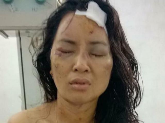 Tin tức trong ngày - Cô giáo bị chồng cũ bạo hành tàn độc như thời trung cổ