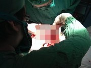 Sức khỏe đời sống - Thử tư thế lạ, nam thanh niên nhập viện