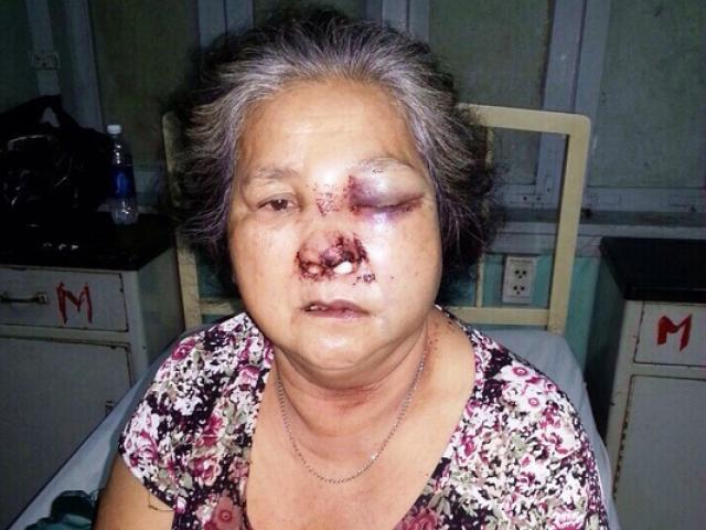 Tin tức trong ngày - Công an cơ sở, anh ở đâu?: Hậu quả đau lòng!