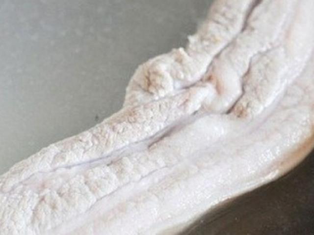 Sức khỏe đời sống - Cảnh báo thói quen ăn thịt dễ gây nguy hiểm tính mạng!