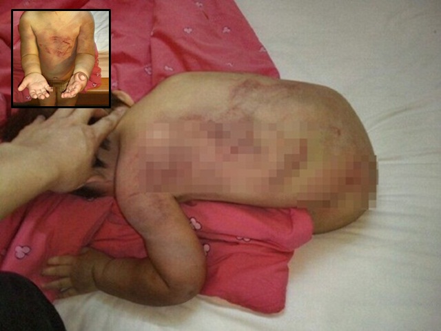 Bạn trẻ - Cuộc sống - Cha ruột đánh đập con gái thậm tệ để dằn mặt vợ cũ