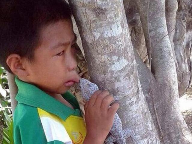 Phi thường - kỳ quặc - Cậu bé Thái Lan bị tắc kè "khóa môi" không rời