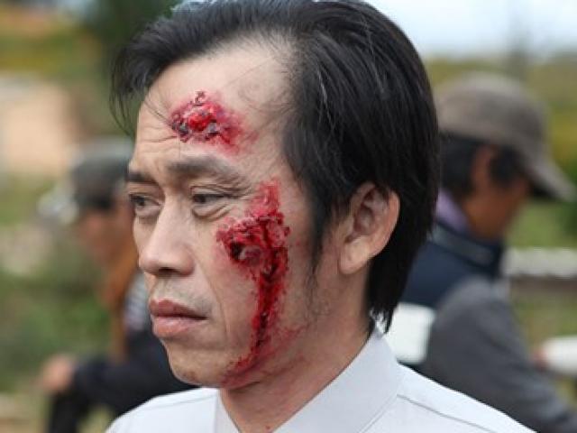 Giải trí - "Mặt nạ máu" và bài toán khó mang tên Hoài Linh