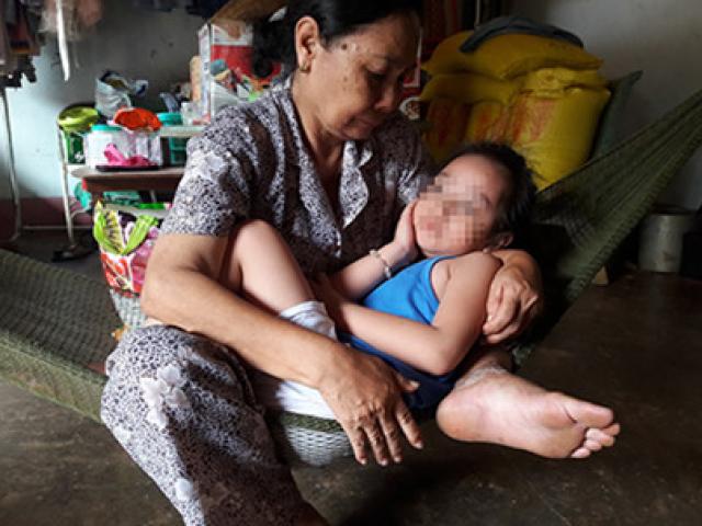 Sức khỏe đời sống - Mất trí nhớ do virus viêm não tấn công