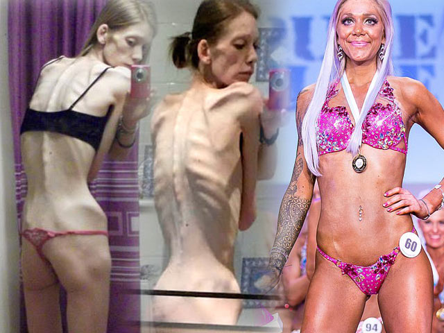 Bí quyết làm đẹp - "Bộ xương khô" nóng bỏng khó ngờ sau 18 tháng