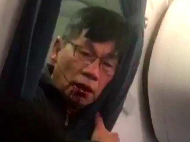 Thế giới - Trump bất bình vụ bác sĩ gốc Việt bị kéo lê khỏi máy bay?