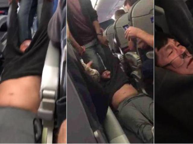 Media - Đồ họa: Toàn cảnh vụ bê bối United Airlines "kéo lê hành khách"