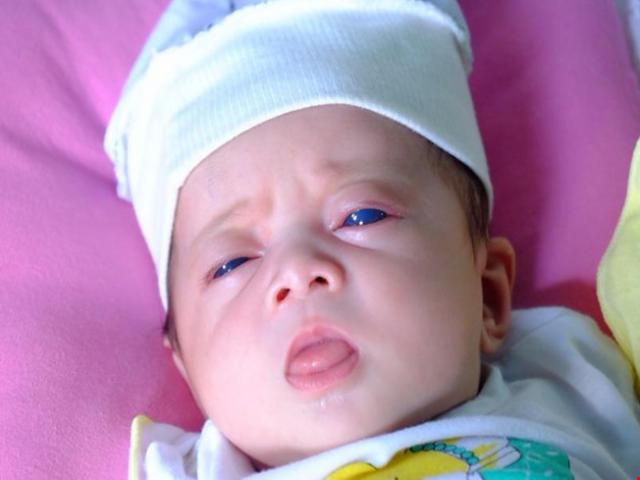 Tin tức trong ngày - "Thiên thần mắt xanh" kỳ lạ chào đời ở Đồng Nai