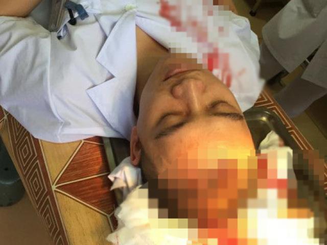 Hà Nội: Bác sĩ bị hành hung, máu đổ trên bệnh án