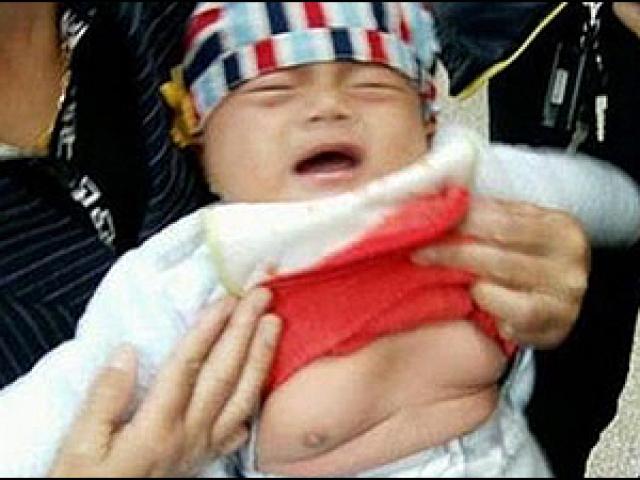 Sức khỏe đời sống - Thức ăn nhanh, béo phì và dậy thì sớm: Phụ huynh đừng ép con mình "chín" sớm