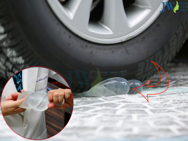 Làm đẹp - Bất ngờ với túi nâng ngực xe ô tô 7 chỗ cán đè không vỡ