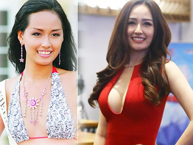 Thẩm mỹ viện - Kiều nữ Việt gây khó hiểu vì vòng 1 "phổng phao" bất thường