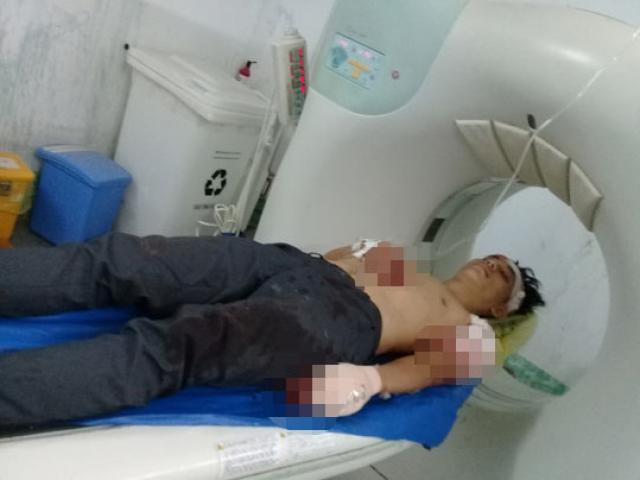 Pháp luật - Chủ tiệm game bị chém dã man giữa đêm khuya