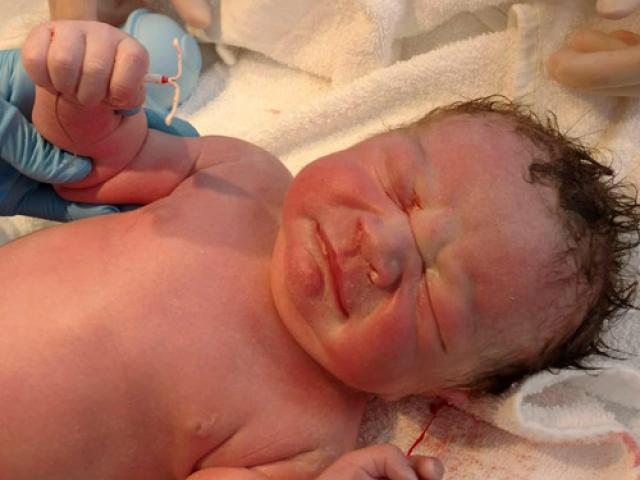 Bạn trẻ - Cuộc sống - Sự thật về bé sơ sinh nắm chặt vòng tránh thai gây sốt