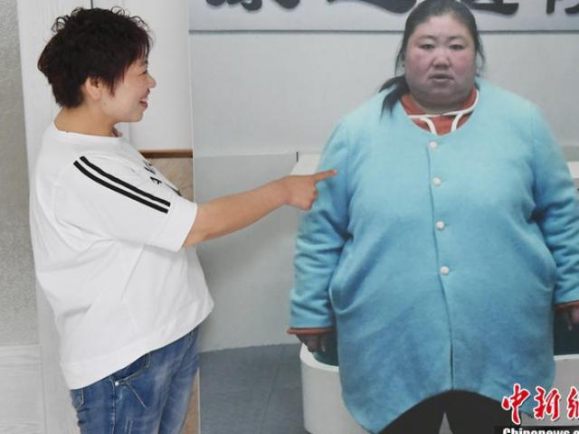 Làm đẹp - Bị chồng bỏ, cô nàng Trung Quốc giảm 121 kg và nhận "quả ngọt"