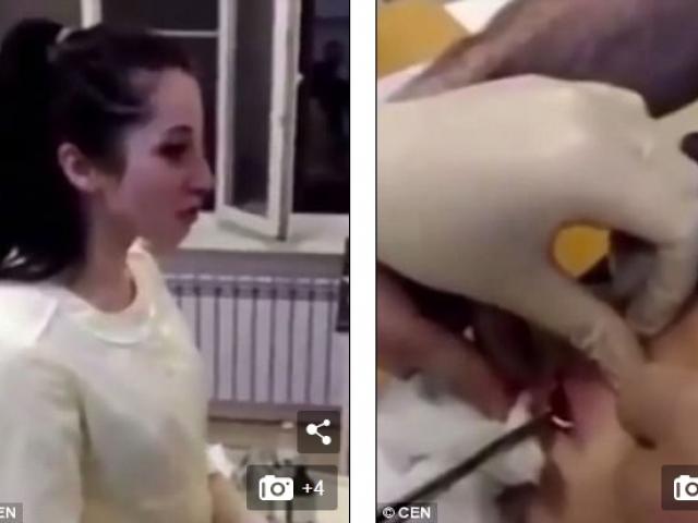 Phi thường - kỳ quặc - Moi vết thương của bạn trai, cô gái choáng khi thấy thứ này