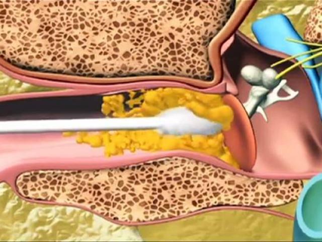 Sức khỏe đời sống - Thủ phạm khiến hàng nghìn trẻ nhập viện mỗi năm mà cha mẹ vẫn vô tư sử dụng