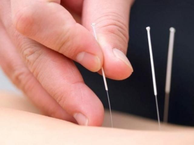 Sức khỏe đời sống - Sai lầm khi tự ý chữa liệt mặt, méo mồm