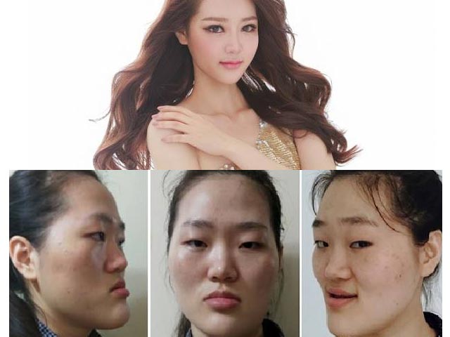 Thẩm mỹ viện - Vỡ mộng khi ngắm "mặt nguyên thủy" của loạt gái đẹp Hàn