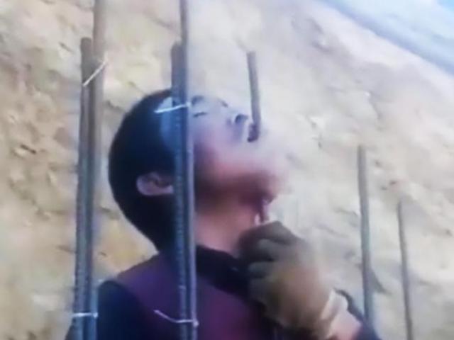 Phi thường - kỳ quặc - Kinh dị cảnh công nhân TQ bị thanh thép chọc xuyên hàm