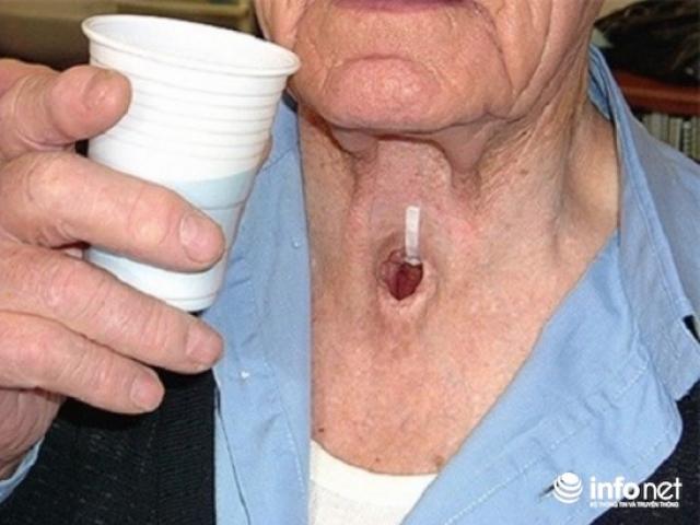 Sức khỏe đời sống - Thủ phạm êm ái gây ung thư xuất hiện hằng ngày