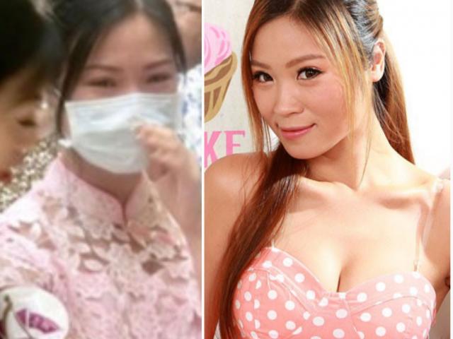 Đời sống Showbiz - Người đẹp "dao kéo": Gương mặt bị hoại tử, sẹo chằng chịt