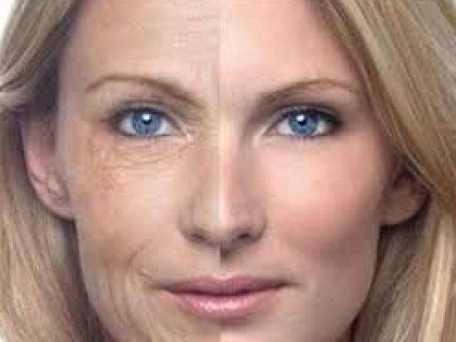 Sức khỏe đời sống - Có nên xóa nếp nhăn bằng chất lỏng nhân tạo?