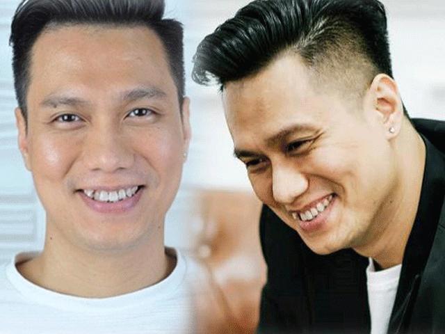 Người mẫu - Hoa hậu - "Thiếu gia Phan Hải" sửa bộ phận này hóa ngay soái ca 100%