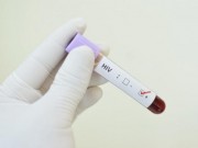 Sức khỏe đời sống - Cuba ngăn chặn thành công virus HIV truyền từ mẹ sang con