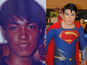 Thẩm mỹ viện - "Siêu nhân" tiêm chất độc để bụng, ngực "rắn như thép"